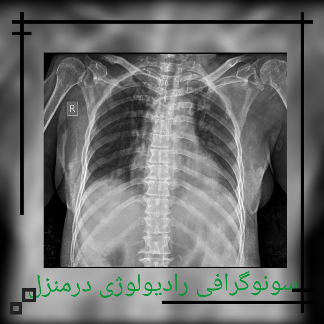 سونوگرافی در منزل تهران کرج مشهد گرفتن عکس رادیولوژی در منزل و خانه تهران کرج مشهد شیراز 