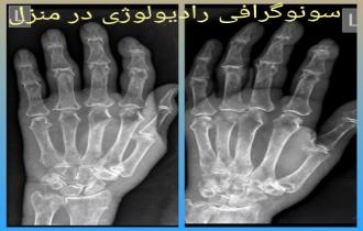 رادیولوژی انگشتان در منزل