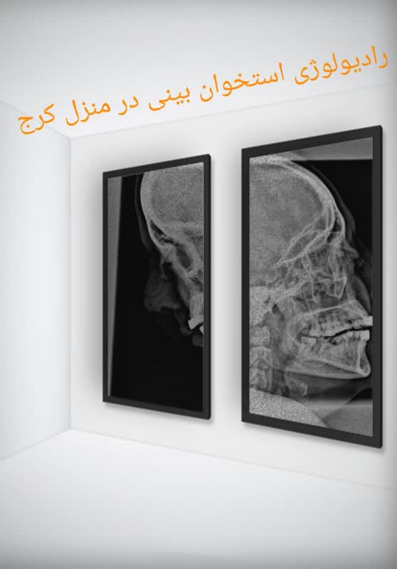 رادیولوژی  استخوان بینی در منزل کرج