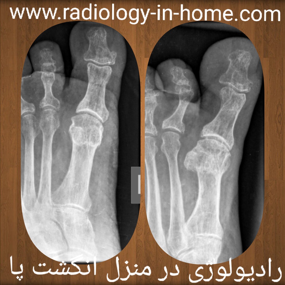 رادیولوژی در منزل انگشتان پا و دست مچ دست ساعد بازو شانه و کتف سونوگرافی در خانه در تهران کرج  شکم و لگن پروستات بیضه  آپاندیس
