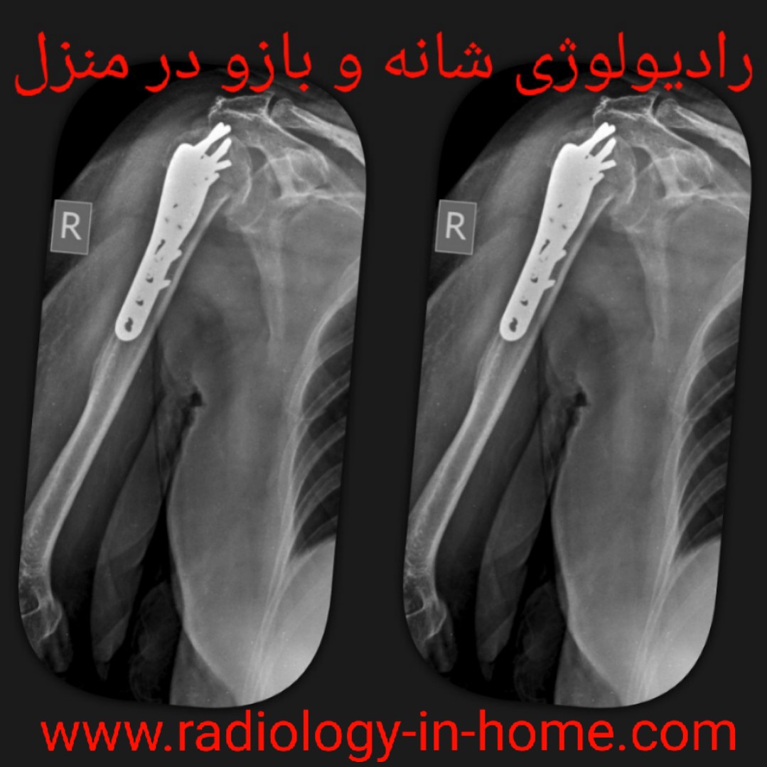 رادیولوژی در منزل در شهر مشهد