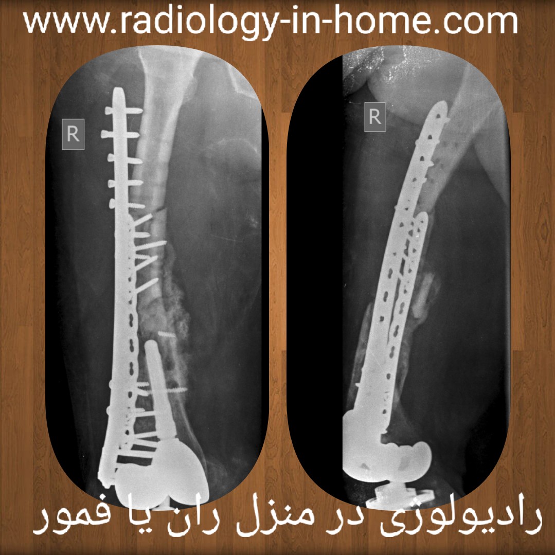 رادیوگرافی در منزل در شیراز