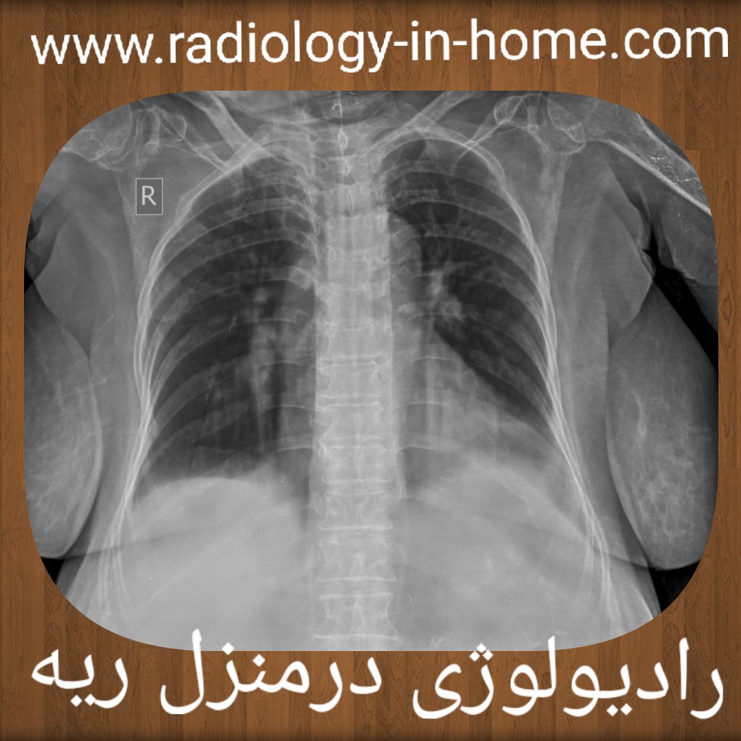 رادیولوژی در منزل ریه و قفسه سینه لگن بینی شکستگی لگن و ران پرتابل و سیار سونو در منزل تهران،خدمات سونوگرافی در منزل