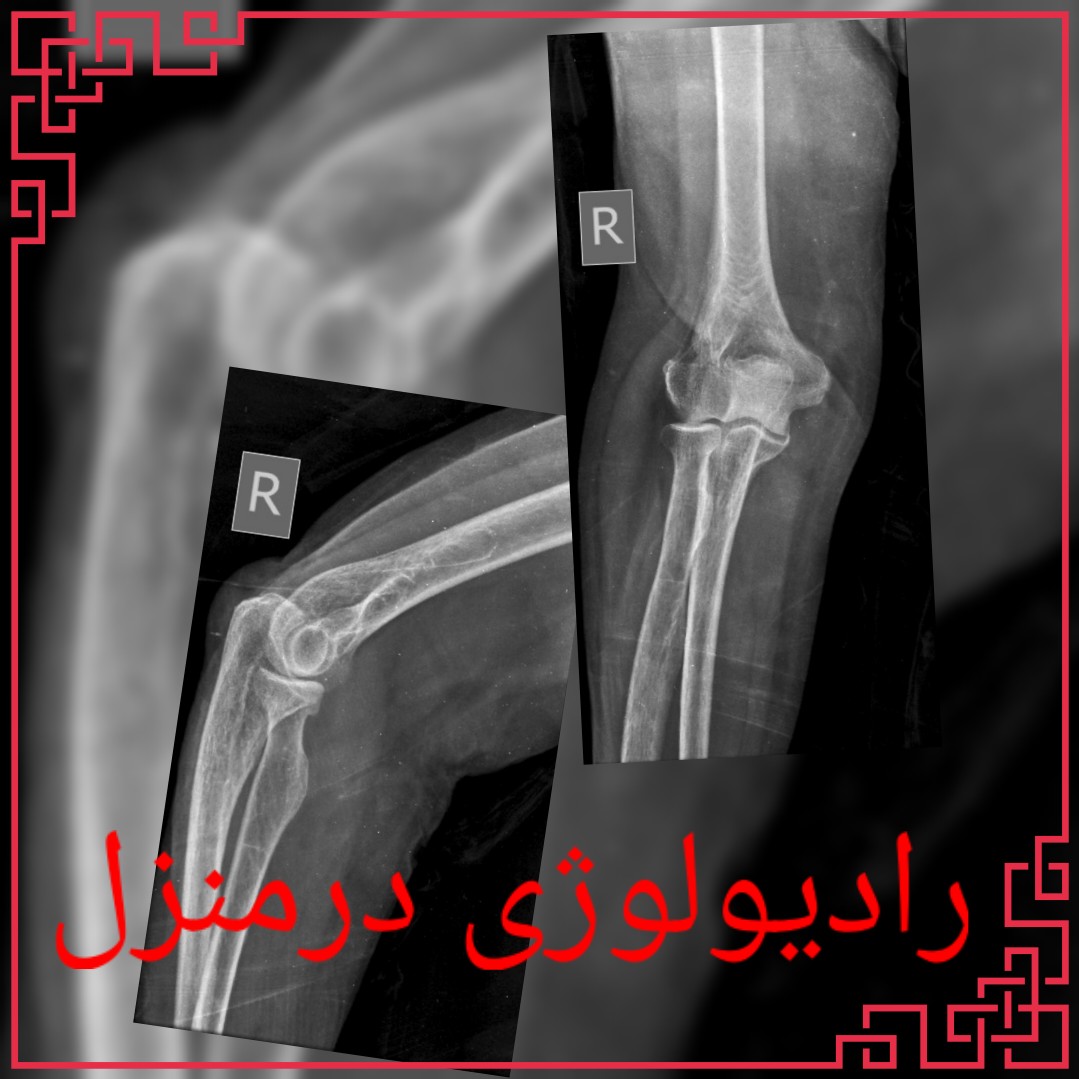 رادیولوژی در منزل تهران از لگن زانو ران ریه و قفسه سینه مچ دست مچ پا مهره های کمری در خانه سیار پرتابل