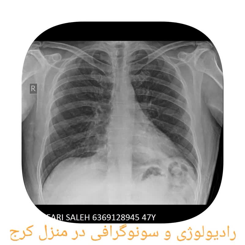 رادیولوژی زیه در منزل کرج