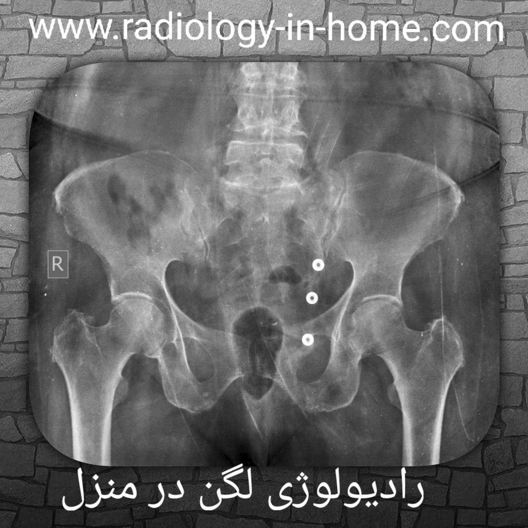 رادیولوژی لگن در منزل