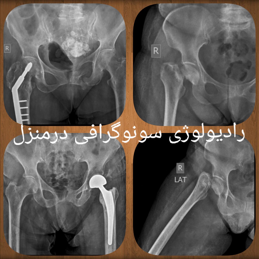رادیولوژی و سونوگرافی در منزل تهران کرج،رادیولوژی در منزل تهران،سونوگرافی در منزل تهرانRadiology at home in Tehran Ultrasound at home in Tehran