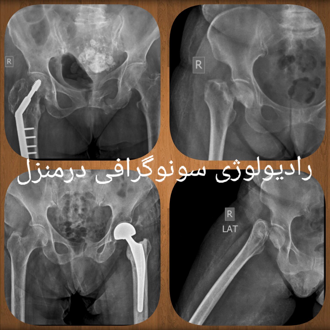 رادیولوژی و سونوگرافی در منزل تهران کرج مشهد