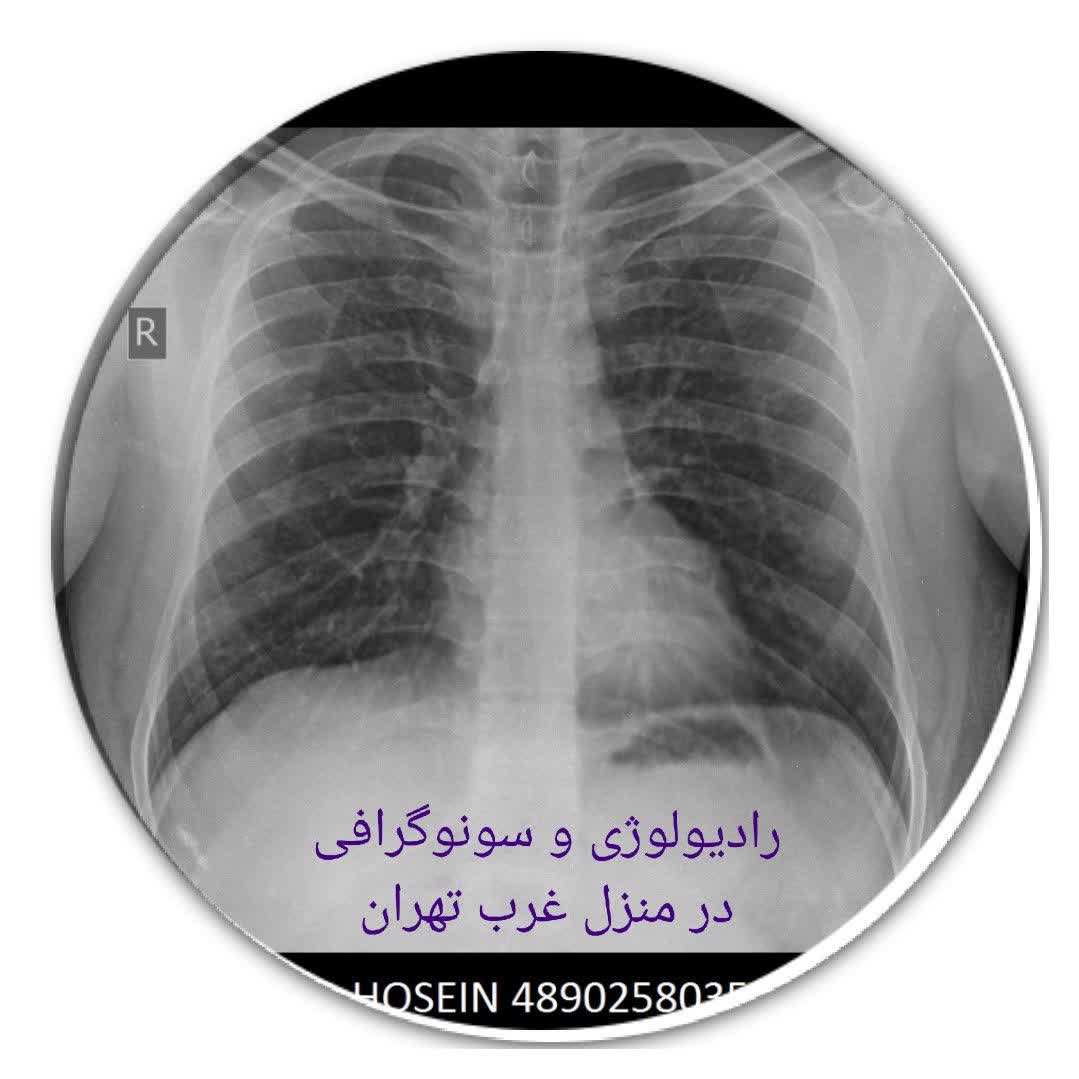 رادیولوژی و سونوگرافی در منزل غرب تهران(1)