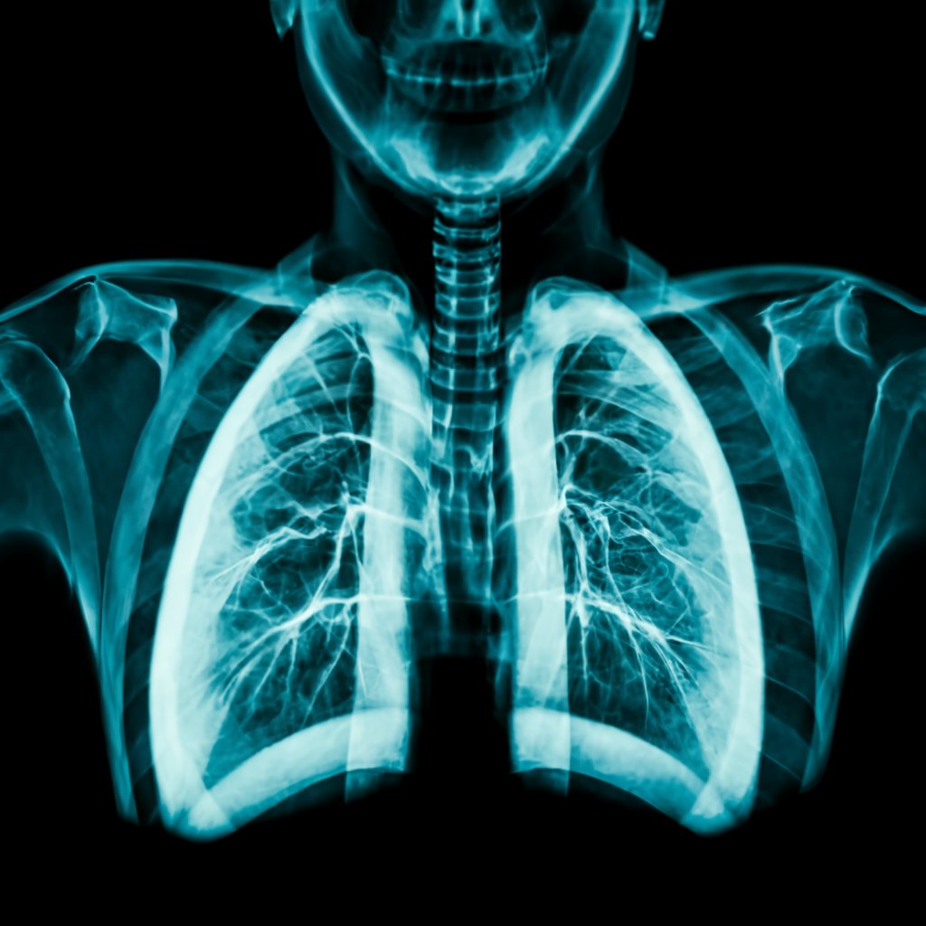 رادیولوژی و سونوگرافی در منزل ریه و قفسه سینه