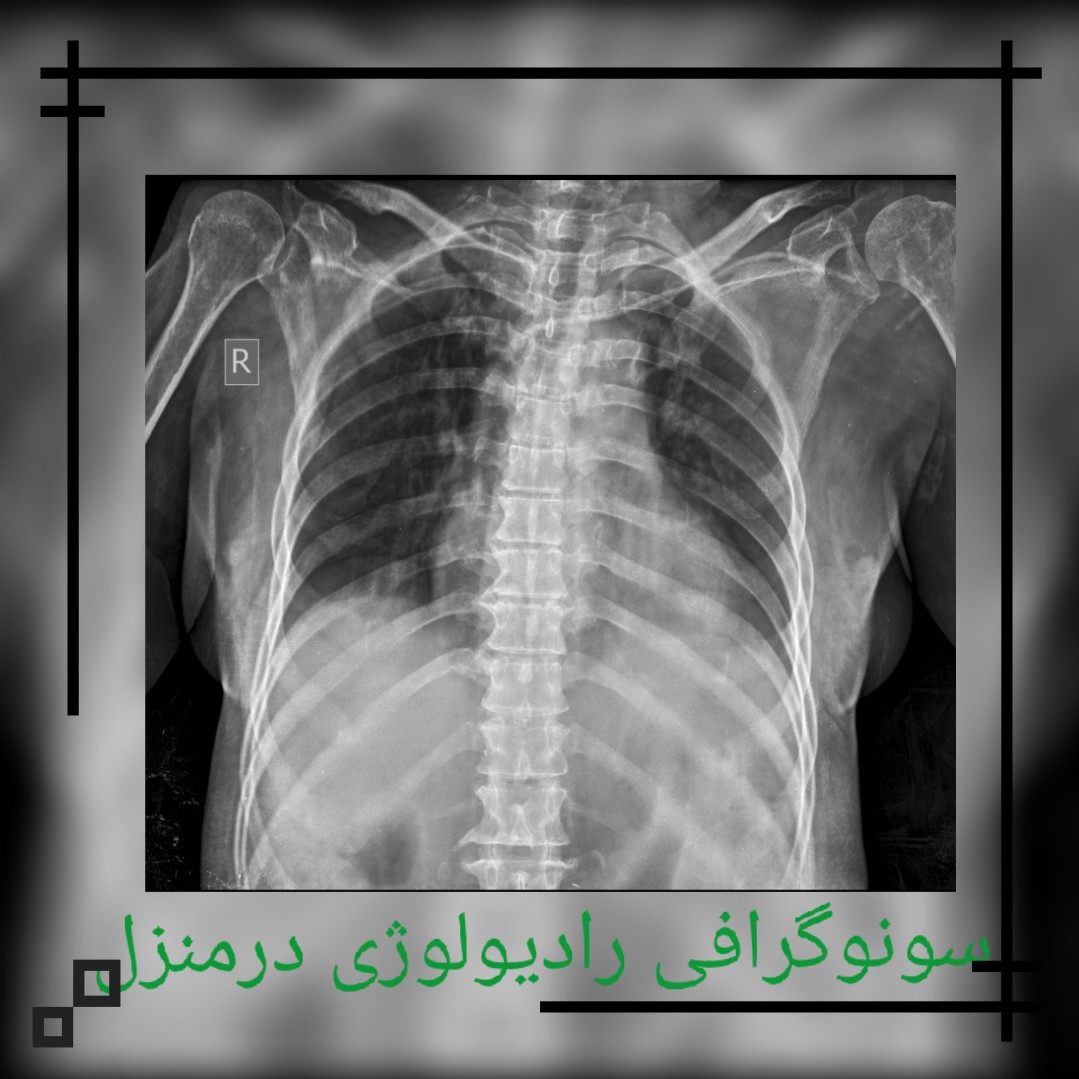 سونوگرافی در منزل تهران کرج ، عکس رادیولوژی در منزل و خانه تهران کرج،رادیوگرافی در منزل تهران Home ultrasound of the abdomen, pelvis, kidneys, bladder, urinary tract, testicles, prostate, color Doppler, superficial soft tissue, pregnancy and pregnancy in Tehran