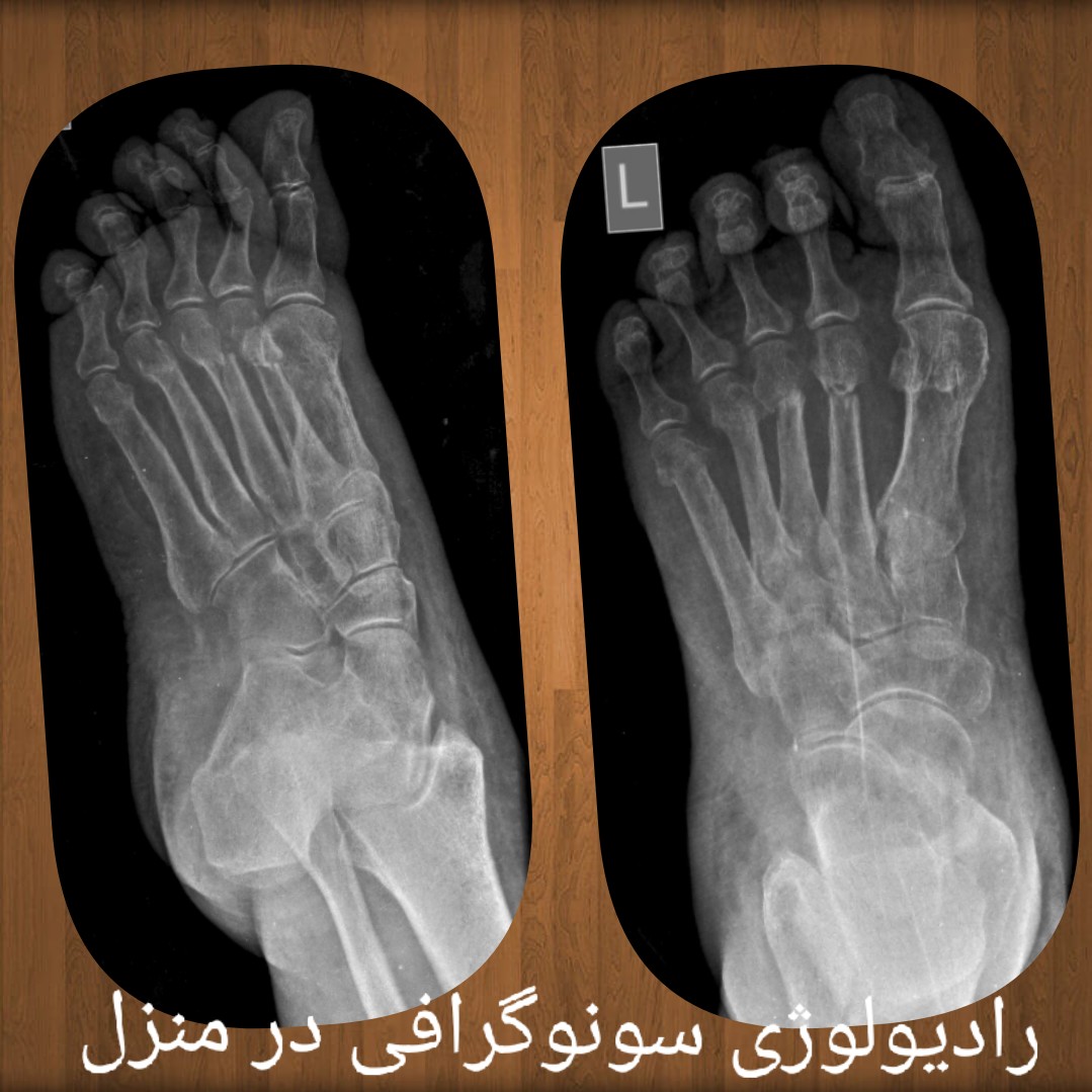 سونوگرافی در منزل کبد و کلیه و بیضه و پروستات و شکم و لگن آپاندیس بارداری و حاملگی داپلر عروق تهران کرج رادیولوژی در منزل تهران Radiography at home in Tehran  Ultrasound at home in Tehran