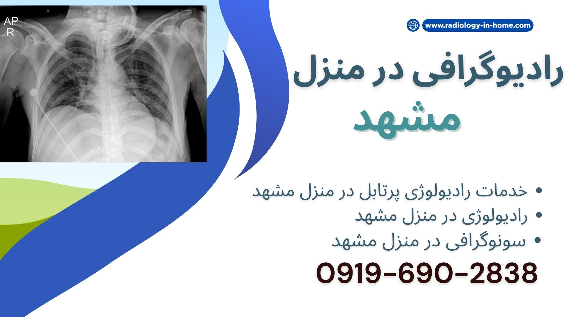 رادیولوژی شبانه روزی در منزل مشهد