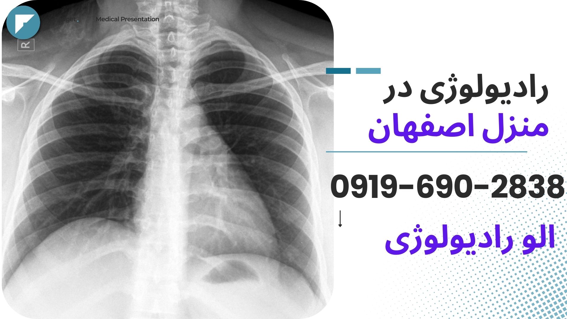 رادیولوژی در منزل اصفهان