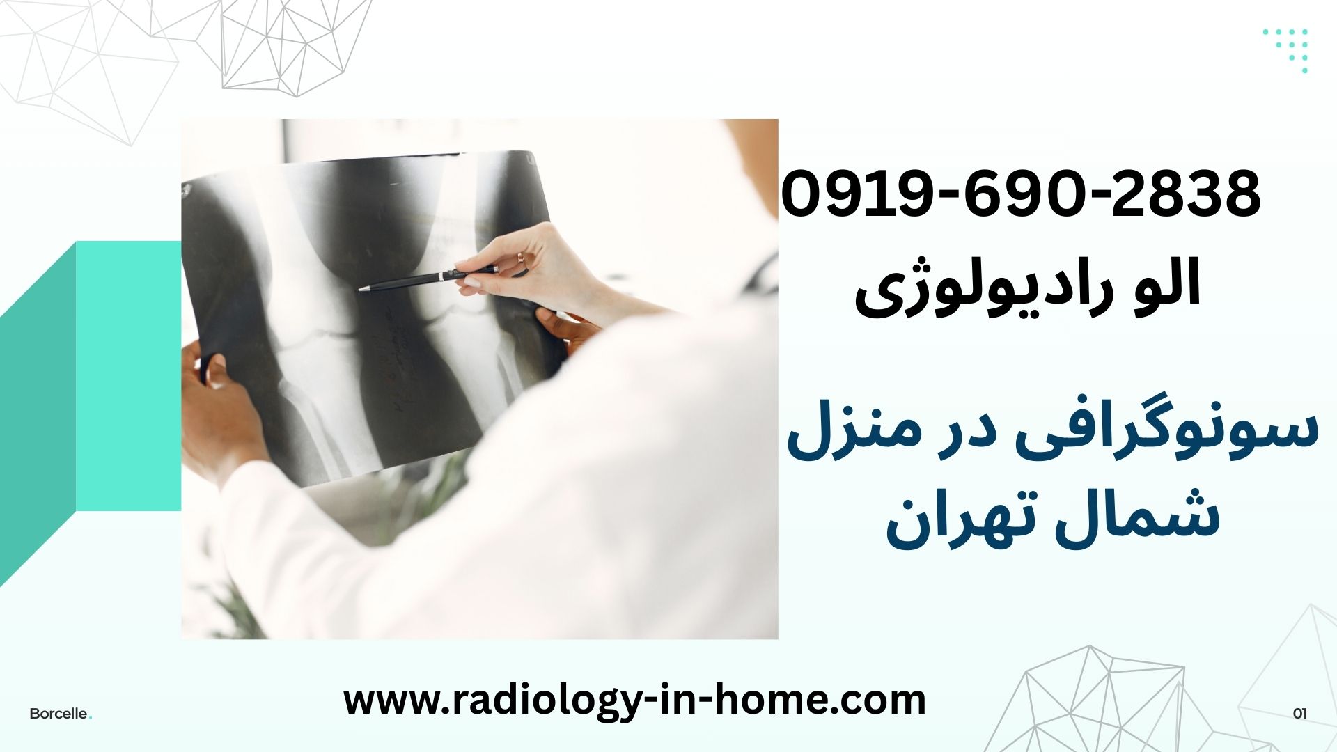 رادیولوژی لگن در منزل شمال تهران