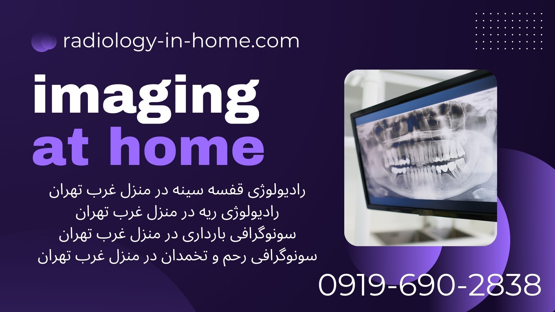 رادیولوژی و سونوگرافی در منزل غرب تهران با تجهیزات پرتابل رادیولوژی در منزل غرب تهران شبانه‌روزی  رادیولوژی فوری در منزل غرب تهران  رادیولوژی سیار در منزل غرب تهران  هزینه رادیولوژی در منزل غرب تهران  بهترین رادیولوژی در منزل غرب تهران  عکسبرداری در منزل غرب تهران  رادیولوژی سالمندان در منزل غرب تهران  رادیولوژی بعد از جراحی در منزل غرب تهران