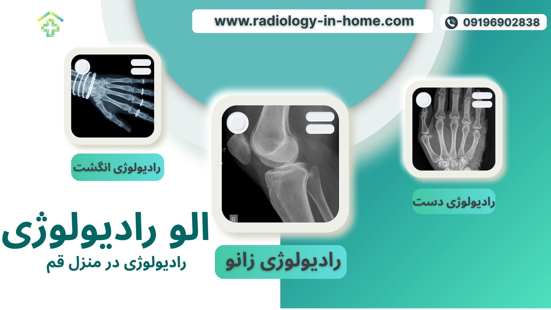رادیولوژی در منزل قم