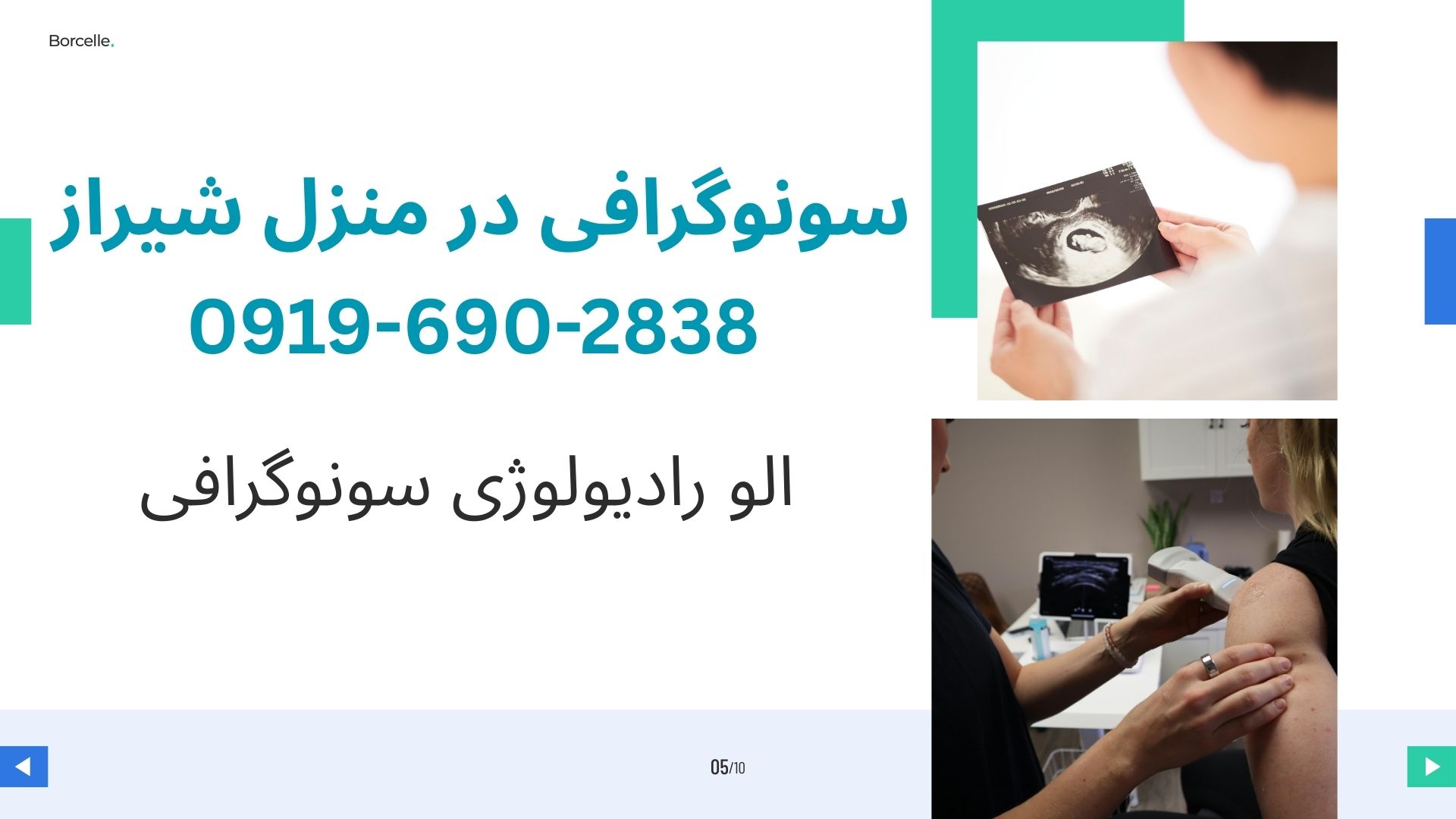 سونوگرافی بارداری و رحم و تخمدان در منزل شیراز