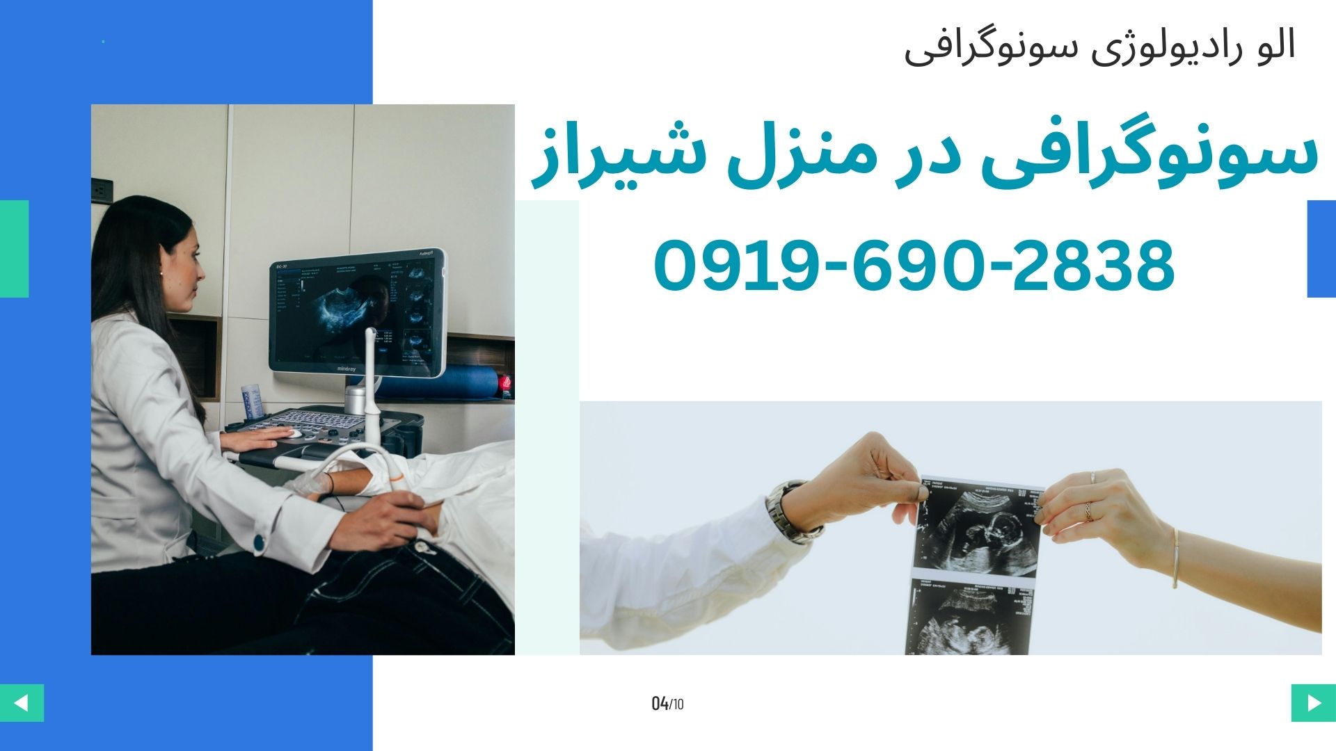 سونوگرافی داپلر در منزل شیراز