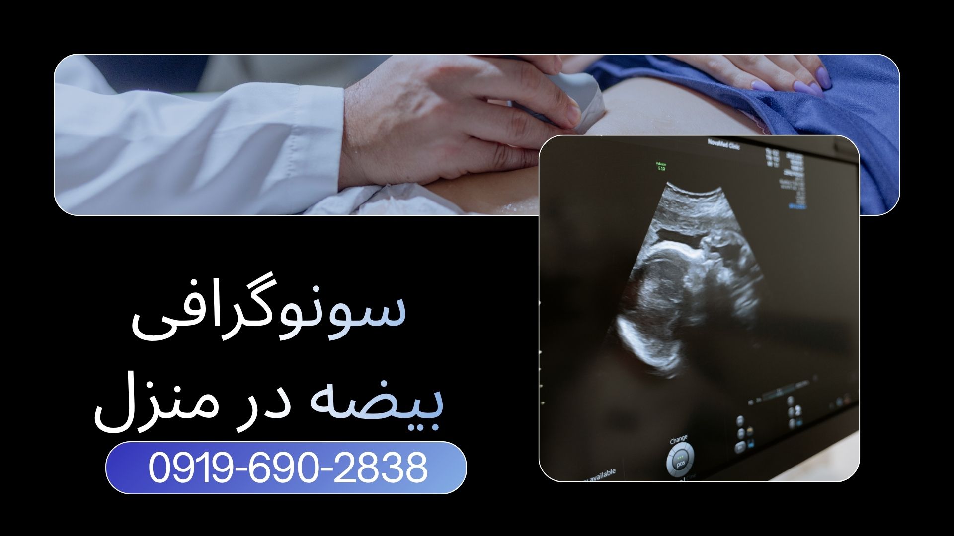 سونوگرافی بیضه و پروستات در منزل کرج توسط پزشک متخصص با دستگاه پرتابل