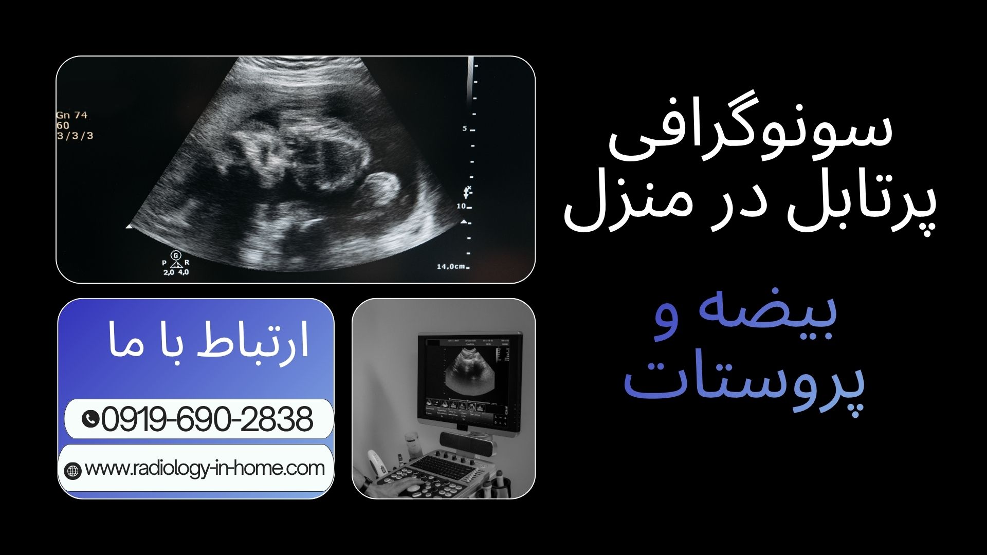 سونوگرافی کالر داپلر بیضه در منزل برای بررسی جریان خون بیضه و تشخیص بیماری‌های عروقی