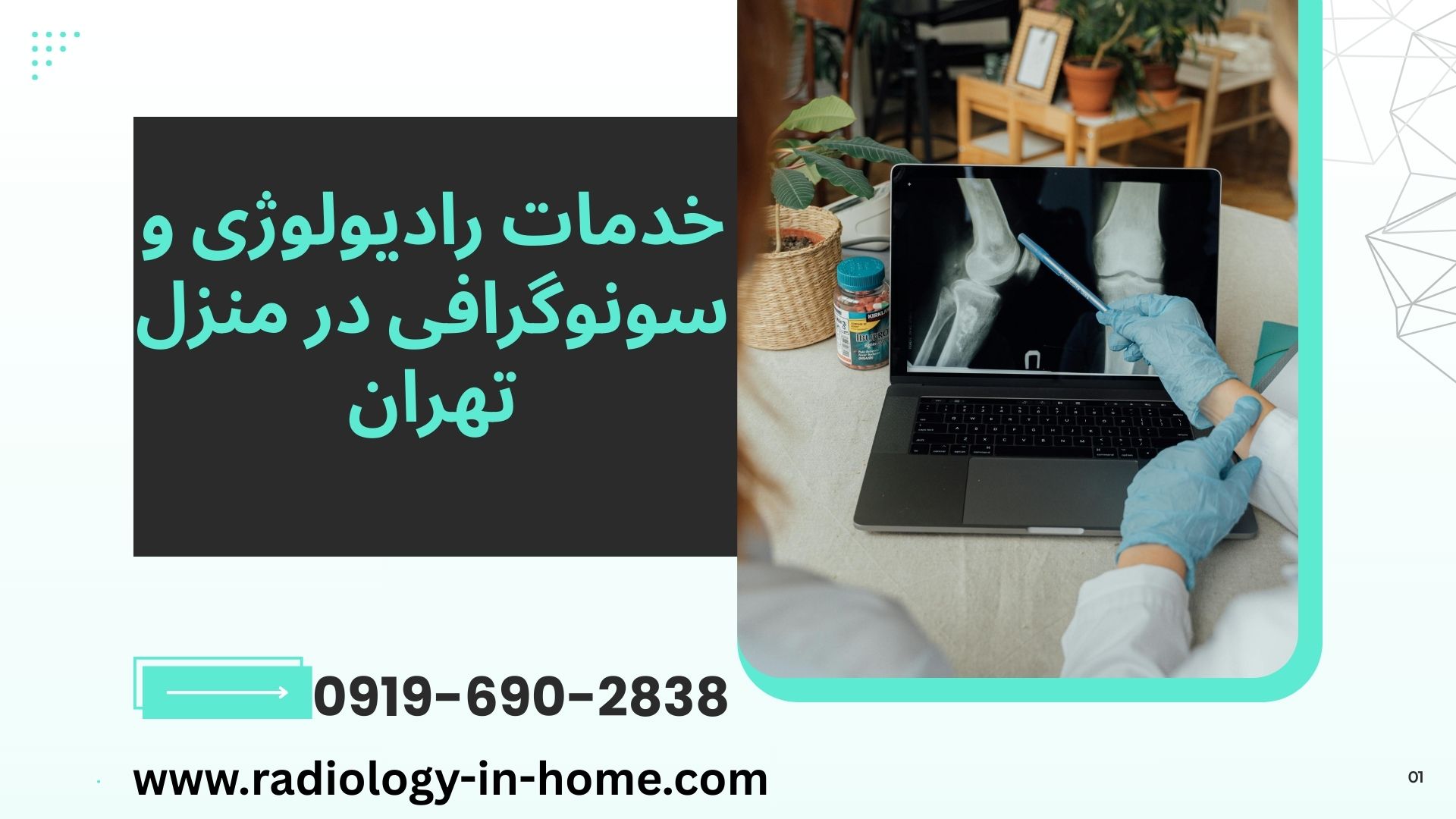 سونوگرافی کلیه و مثانه در منزل شمال تهران