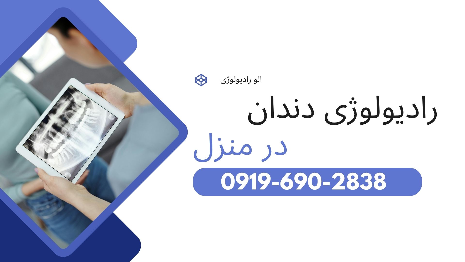 عکس رادیولوژی دندان در منزل تهران و کرج با دستگاه دیجیتال، عکس پری اپیکال PA، بایت وینگ BW، رادیولوژی تک دندان و تصویربرداری دهان و دندان
