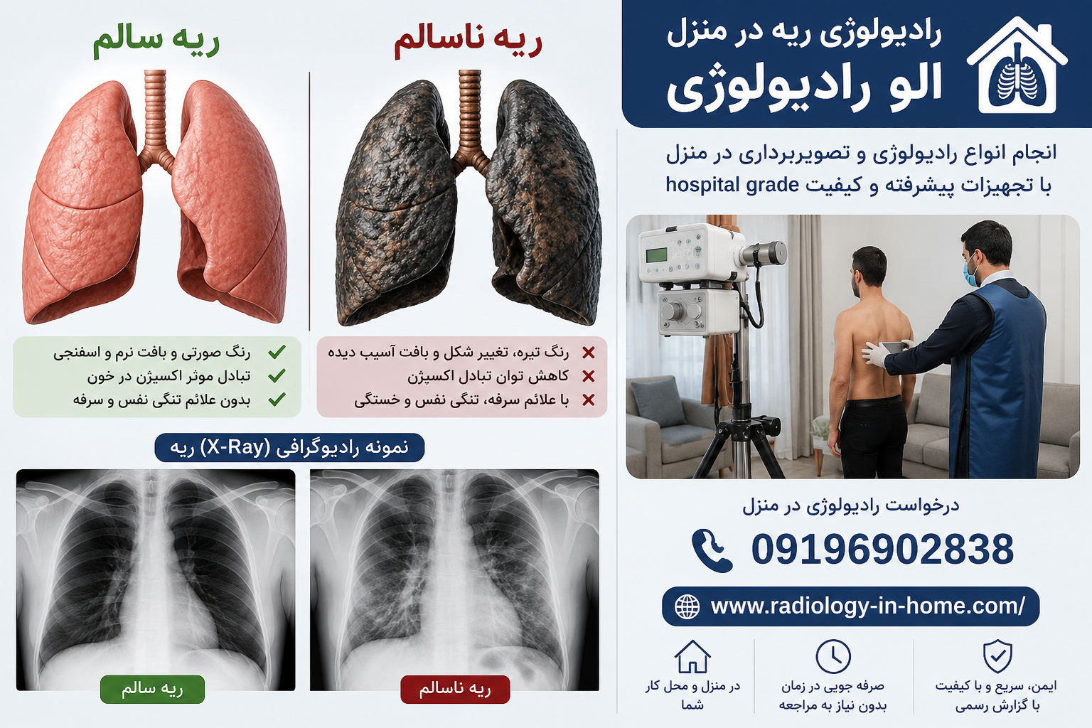 رادیولوژی در منزل از ریه و قفسه سینه، عکس ریه سالم و ناسالم