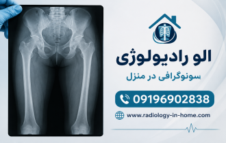 رادیولوژی ران یا فمور در منزل 