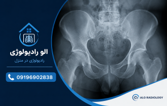 رادیولوژی لگن در منزل