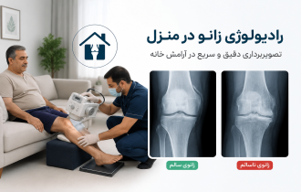 رادیولوژی زانو در منزل تهران و کرج