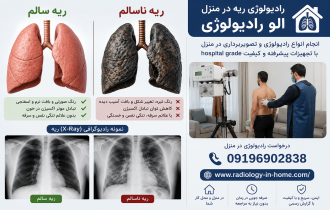 رادیولوژی در منزل از ریه و قفسه سینه، عکس ریه سالم و ناسالم