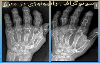 رادیولوژی انگشتان دست و پا در منزل