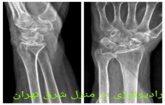 رادیولوژی در منزل مچ پا و مچ دست در تهران و کرج