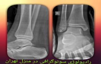 کاربرد های عکس  رادیولوژی در منزل 