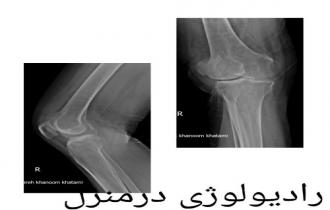 رادیولوژی و سونوگرافی در منزل در قم و قزوین