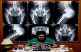 رادیولوژی در منزل در تهران و کرج