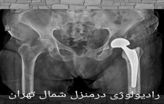  رادیولوژی،سونوگرافی در منزل شمال تهران